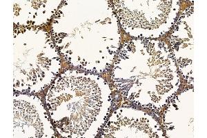ABIN7096241 and ABIN7100303 at 1/100 staining rat testis tissue by IHC-P. (SAMD3 antibody)