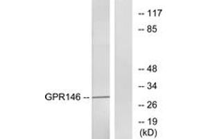 Western blot analysis of extracts from LOVO cells, using GPR146 Antibody. (GPR146 antibody  (AA 191-240))