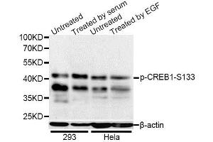 Western blot analysis of extracts of 293 and HeLa cells, using Phospho-CREB1-S133 antibody (ABIN5969880) at 1/1000 dilution. (CREB1 antibody  (pSer133))