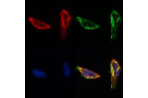 ABIN6261894 and ABIN6268716 staining Hela by IF/ICC.