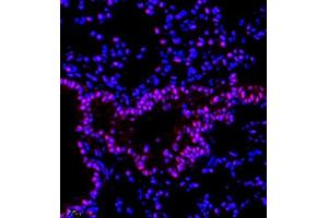 Immunofluorescence (Paraffin-embedded Sections) (IF (p)) image for anti-RB-Associated KRAB Zinc Finger (RBAK) antibody (ABIN7075383)