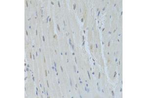 Immunohistochemistry (Paraffin-embedded Sections) (IHC (p)) image for anti-Heterogeneous Nuclear Ribonucleoprotein K (HNRNPK) (AA 1-280) antibody (ABIN3022414)