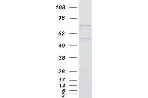 FYB Protein (Transcript Variant 2) (Myc-DYKDDDDK Tag)