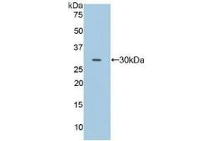 Detection of Recombinant FcgRII, Human using Polyclonal Antibody to Cluster Of Differentiation 32 (CD32) (Fc gamma RII (CD32) (AA 69-309) antibody)