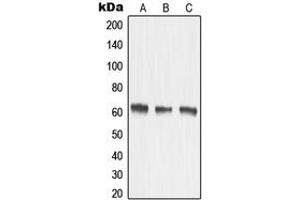 Western blot analysis of MMP15 expression in HeLa (A), mouse kidney (B), rat kidney (C) whole cell lysates.
