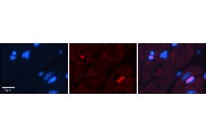 Rabbit Anti-Dpf3 Antibody  Catalog Number: ARP38943_P050 Formalin Fixed Paraffin Embedded Tissue: Human Adult heart  Observed Staining: Nuclear (not in cardiomyocytes but in fibrocytes in endomysium Primary Antibody Concentration: 1:600 Secondary Antibody: Donkey anti-Rabbit-Cy2/3 Secondary Antibody Concentration: 1:200 Magnification: 20X Exposure Time: 0. (DPF3 antibody  (N-Term))