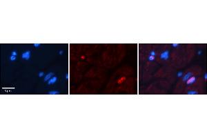 Rabbit Anti-Dpf3 Antibody  Catalog Number: ARP38943_P050 Formalin Fixed Paraffin Embedded Tissue: Human Adult heart  Observed Staining: Nuclear (not in cardiomyocytes but in fibrocytes in endomysium Primary Antibody Concentration: 1:600 Secondary Antibody: Donkey anti-Rabbit-Cy2/3 Secondary Antibody Concentration: 1:200 Magnification: 20X Exposure Time: 0.