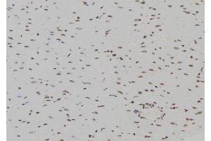 ABIN6266296 and ABIN6277446 at 1/100 staining Rat heart tissue by IHC-P.