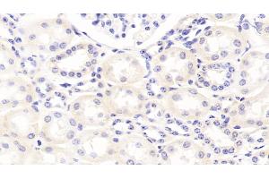 Detection of APOB100 in Bovine Kidney Tissue using Polyclonal Antibody to Apolipoprotein B100 (APOB100) (Apo-B100 antibody  (AA 4331-4567))