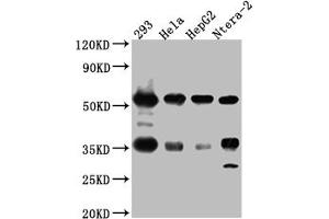 Western Blot Positive WB detected in: 293 whole cell lysate, Hela whole cell lysate, HepG2 whole cell lysate, Ntera-2 whole cell lysate All lanes: NONO Antibody at 1:1000 Secondary Goat polyclonal to rabbit IgG at 1/50000 dilution Predicted band size: 55, 44 kDa Observed band size: 55 kDa (Recombinant NONO antibody)