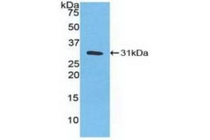 Detection of Recombinant CA3, Human using Polyclonal Antibody to Carbonic Anhydrase III, Muscle Specific (CA3) (CA3 antibody  (AA 2-260))
