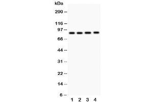 Western blot testing of NOX5 antibody and  Lane 1: 22RV1 (NOX5 antibody  (C-Term))