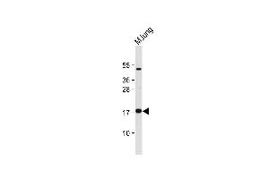 Anti-IER3 Antibody (N-term) at 1:2000 dilution +Mouse lung lysate Lysates/proteins at 20 μg per lane.