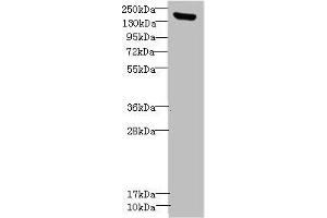 Western blot All lanes: CNTNAP1antibody IgG at 1. (CNTNAP1 antibody  (AA 20-300))