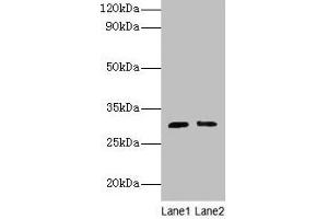 Western blot All lanes: Cd82 antibody at 2 μg/mL Lane 1: Jurkat whole cell lysate Lane 2: A549 whole cell lysate Secondary Goat polyclonal to rabbit IgG at 1/10000 dilution Predicted band size: 30 kDa Observed band size: 30 kDa (CD82 antibody  (AA 111-227))
