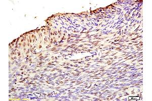 Formalin-fixed and paraffin embedded rat uterus labeled with Anti MAFbx/Fbx32 Polyclonal Antibody, Unconjugated (bs2591R) at 1:200 followed by conjugation to the secondary antibody and DAB staining. (FBXO32 antibody  (AA 31-130))