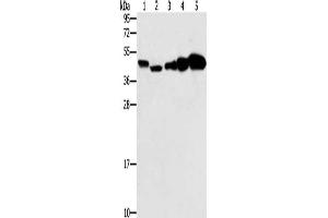 Gel: 10 % SDS-PAGE, Lysate: 40 μg, Lane 1-5: Hela cells, Raji cells, Jurkat cells, A549 cells, NIH/3T3 cells, Primary antibody: ABIN7130674(PPAT Antibody) at dilution 1/250, Secondary antibody: Goat anti rabbit IgG at 1/8000 dilution, Exposure time: 20 seconds (PPAT antibody)