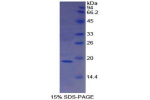 SDS-PAGE (SDS) image for Coagulation Factor VIII (F8) (AA 1887-2044) protein (His tag) (ABIN1170103) (Factor VIII Protein (AA 1887-2044) (His tag))