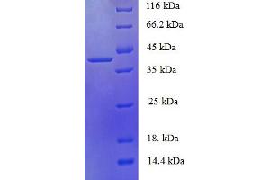 SDS-PAGE (SDS) image for phosphohistidine Phosphatase 1 (PHPT1) (AA 1-125), (full length) protein (GST tag) (ABIN5710093) (PHPT1 Protein (AA 1-125, full length) (GST tag))