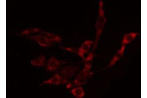 ABIN6272381 staining LOVO by IF/ICC. (PAK7 antibody  (C-Term))