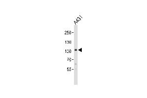Western blot analysis of lysate from A431 cell line, using COL6A1 Antibody at 1:1000.