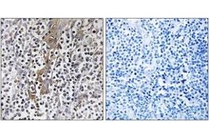 Immunohistochemistry analysis of paraffin-embedded human tonsil, using TMC8 Antibody. (TMC8 antibody  (AA 601-650))