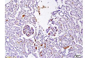 Formalin-fixed and paraffin embedded rat nephroblastoma labeled with Anti SET Polyclonal Antibody, Unconjugated (ABIN760166) at 1:200 followed by conjugation to the secondary antibody and DAB staining (SET/TAF-I antibody)