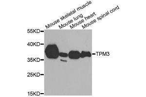 Western blot analysis of extracts of various cell lines, using TPM3 antibody. (TPM3 antibody  (AA 1-284))
