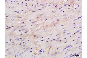 Formalin-fixed and paraffin embedded mouse heart labeled with Rabbit Anti H Cadherin/T cadherin Polyclonal Antibody, Unconjugated (ABIN715271) at 1:200 followed by conjugation to the secondary antibody and DAB staining (Cadherin 13 antibody  (AA 301-400))