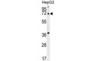 Western Blotting (WB) image for anti-Acyl-CoA Thioesterase 11 (ACOT11) antibody (ABIN2995532)