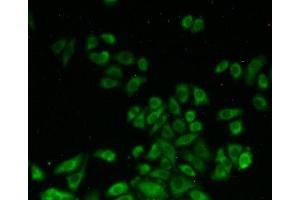 Detection of SHMT2 in Hela cells using Polyclonal Antibody to Serine Hydroxymethyltransferase 2, Mitochondrial (SHMT2)