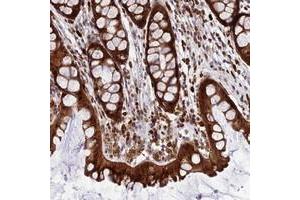 Immunohistochemical staining of human colon with JSRP1 polyclonal antibody  shows strong cytoplasmic and nuclear positivity in glandular cells.