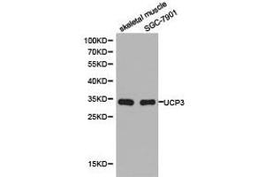 Western Blotting (WB) image for anti-Uncoupling Protein 3 (Mitochondrial, Proton Carrier) (UCP3) antibody (ABIN1875270) (UCP3 antibody)
