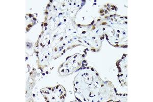 Immunohistochemistry of paraffin-embedded human placenta using FOSB Rabbit pAb (ABIN7267159) at dilution of 1:150 (40x lens). (FOSB antibody  (AA 1-100))