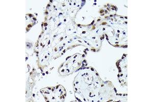 Immunohistochemistry of paraffin-embedded human placenta using FOSB Rabbit pAb (ABIN7267159) at dilution of 1:150 (40x lens).