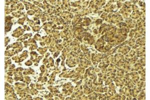 ABIN6275418 at 1/100 staining Mouse pancreas tissue by IHC-P.