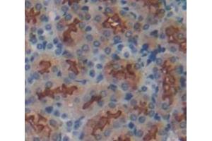 IHC-P analysis of Mouse Tissue, with DAB staining. (ITGB1 antibody  (AA 454-714))