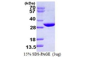 SDS-PAGE (SDS) image for CutC Copper Transporter Homolog (CUTC) (AA 1-273) protein (His tag) (ABIN667532) (CUTC Protein (AA 1-273) (His tag))