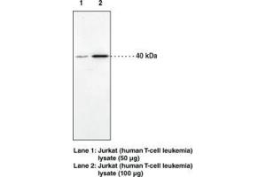 Image no. 1 for anti-Cannabinoid Receptor 2 (CNR2) (AA 20-33) antibody (ABIN1491167) (CNR2 antibody  (AA 20-33))