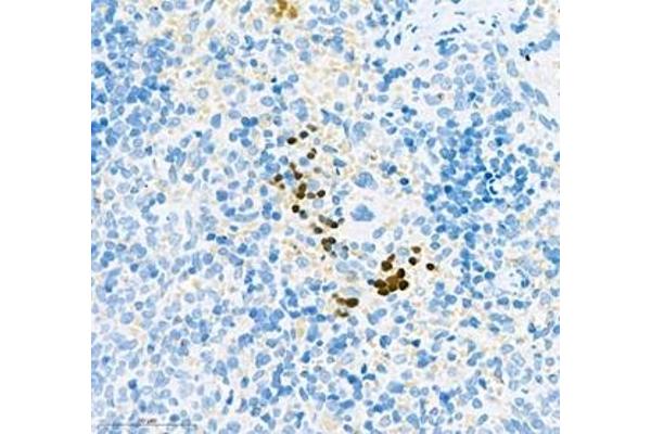 aHSP antibody