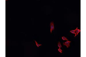 ABIN6266637 staining A549? (CSTB antibody  (C-Term))