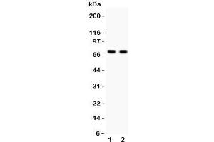 Western blot testing of SHBG antibody and Lane 1:  HeLa;  2: COLO320;  Predicted size per AA content: 44KD, but this highly glycosylated protein is observed up to 100KD (SHBG antibody  (AA 30-210))