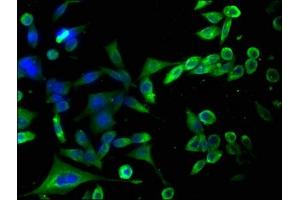 Immunofluorescence staining of SH-SY5Y cells with ABIN7155933 at 1:100, counter-stained with DAPI. (HAP1 antibody  (AA 328-580))