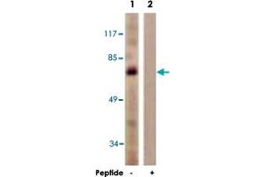 Western blot analysis of extracts from HUVEC cells, using MYB polyclonal antibody .