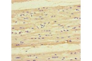 Immunohistochemistry of paraffin-embedded human heart tissue using ABIN7157751 at dilution of 1:100 (KYNU antibody  (AA 99-214))