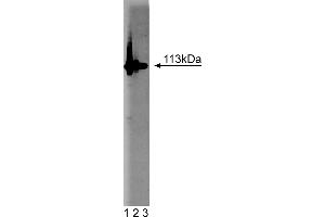 Western Blotting (WB) image for anti-Poly (ADP-Ribose) Polymerase 1 (PARP1) (AA 22-219) antibody (ABIN968333) (PARP1 antibody  (AA 22-219))