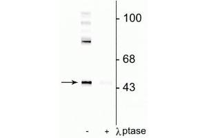 Western blot of rat cortical lysate showing specific immunolabeling of the ~50 kDa Gap-43 protein phosphorylated at Ser41 in the first lane (-). (GAP43 antibody  (pSer41))