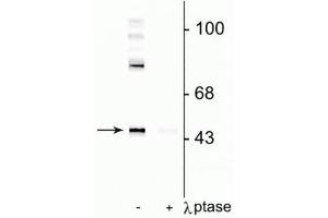 Western blot of rat cortical lysate showing specific immunolabeling of the ~50 kDa Gap-43 protein phosphorylated at Ser41 in the first lane (-).