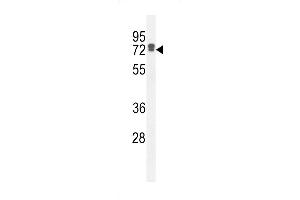 LRC40 Antibody (C-term) (ABIN654977 and ABIN2844617) western blot analysis in HepG2 cell line lysates (35 μg/lane). (LRRC40 antibody  (C-Term))