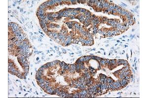 Immunohistochemical staining of paraffin-embedded Human Kidney tissue using anti-IGF2BP2 mouse monoclonal antibody. (IGF2BP2 antibody)